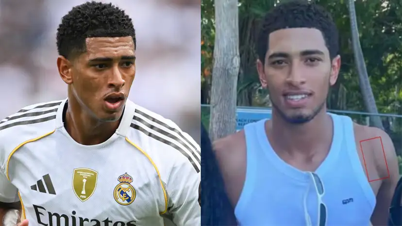 Jude Bellingham has shown off his shoulder surgery scar, with the Real Madrid star set to miss the start of the 2025-26 campaign.